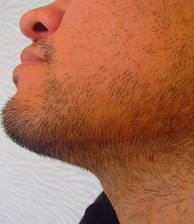 �P�H �E�� �E�E�ёO