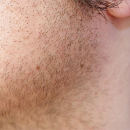 �P�H �E�� ���݂����E�ёO