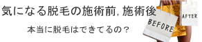 よく聞く永久脱毛って何？